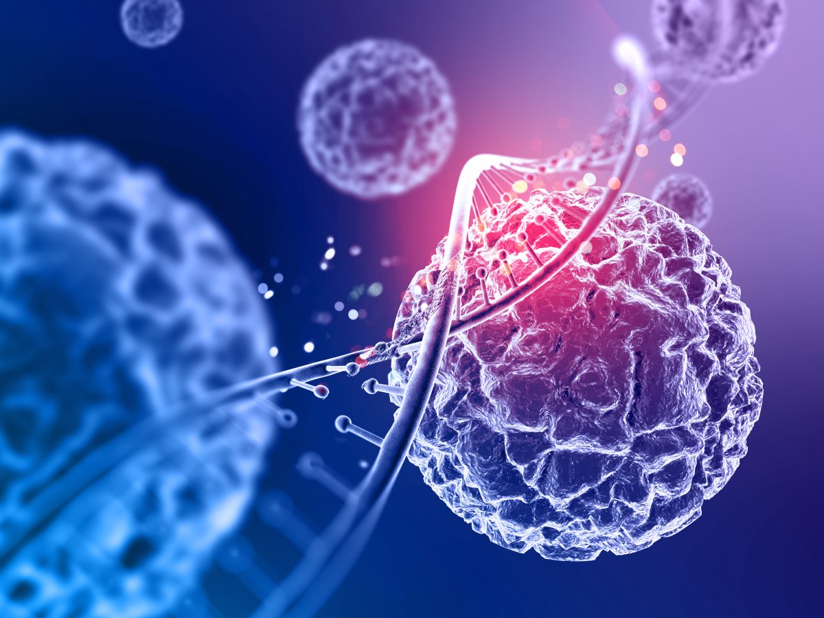 Dynamics of cell death due to electroporation using different pulse ...